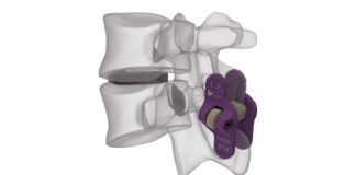 Hilfen für die Wirbelsäule: Spineart entwickelt medizinische Geräte für Chirugen und OP-Teams.